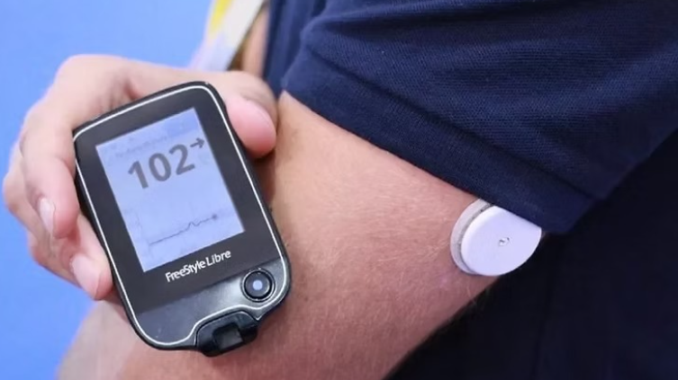 Saúde de Palmas vai distribuir sensores de glicose para crianças e adolescentes com diabetes tipo 1